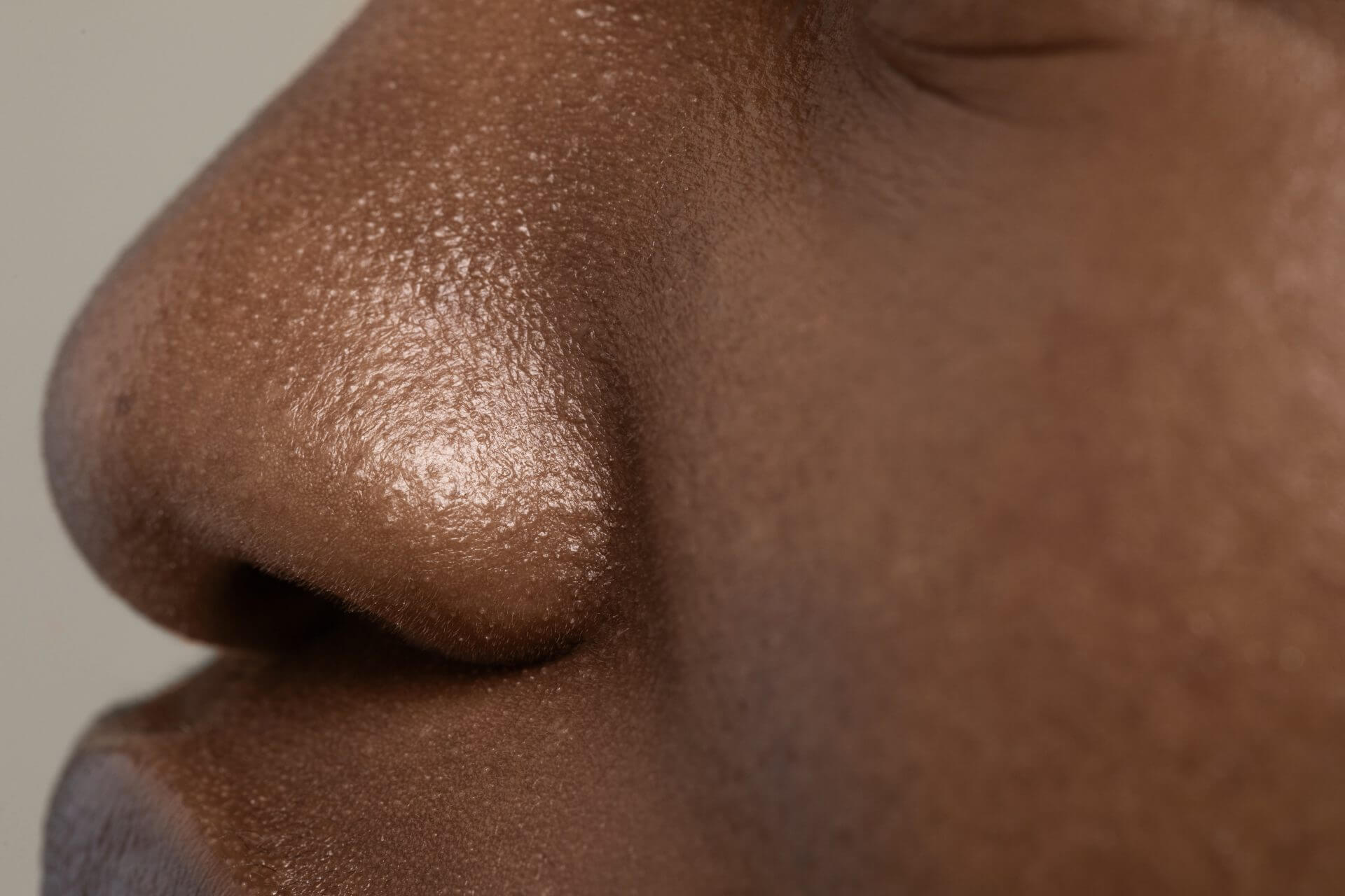 Close up of facial thick skin
