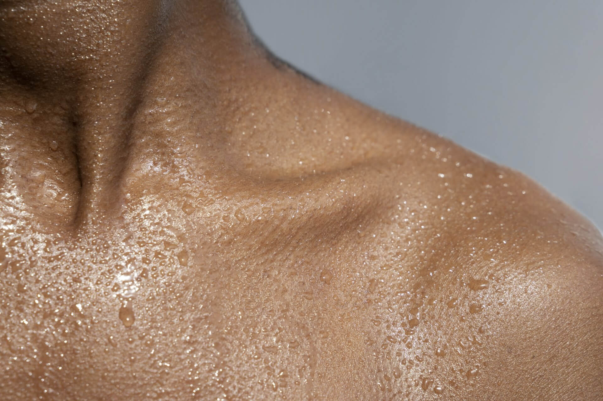 Close up of body with oily skin