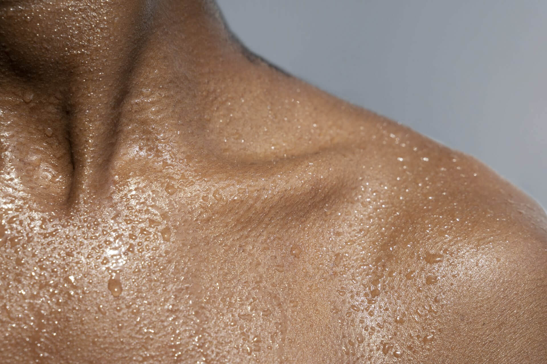 Close up of body with oily skin