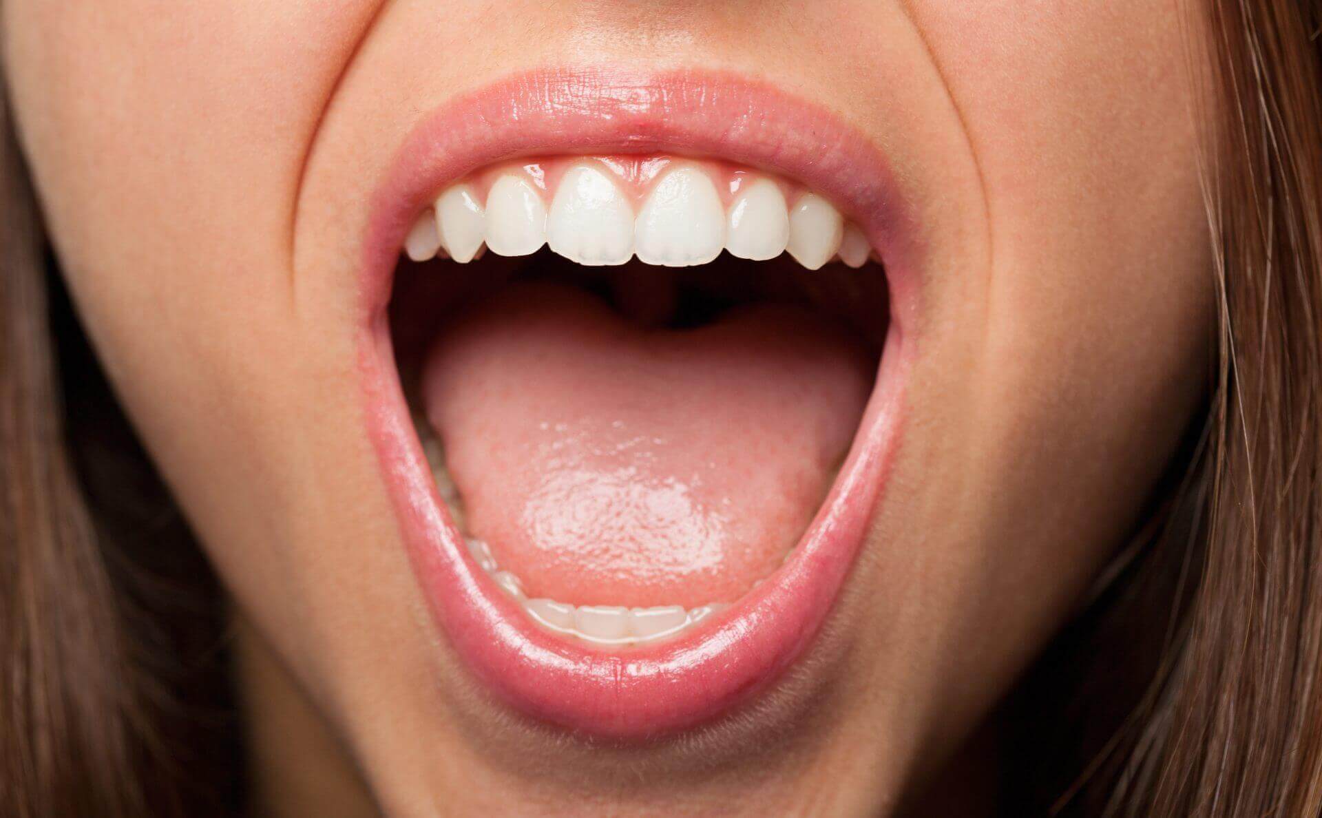 woman who has had laser gum reshaping