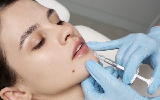injecting hyaluronidase correcting lip filler lumps