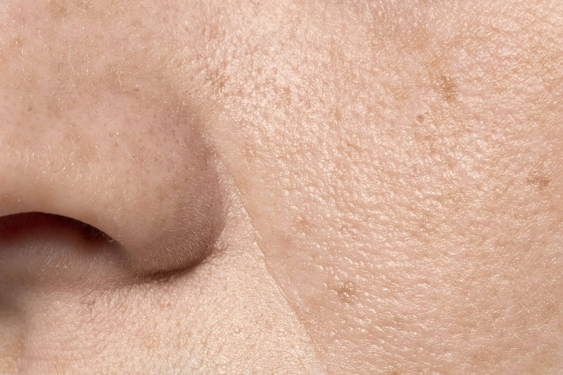 close up of facial pores