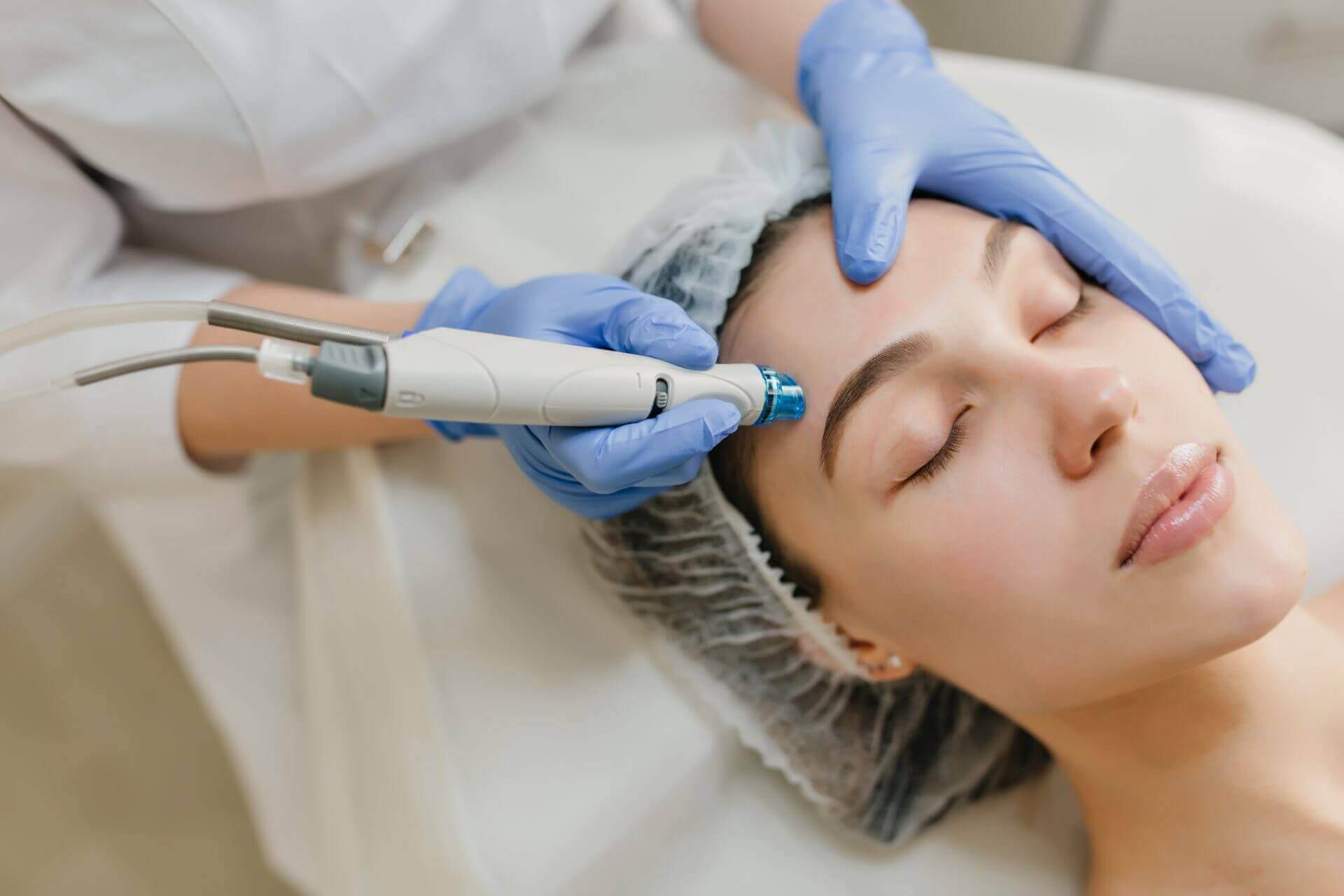 microneedling procedure