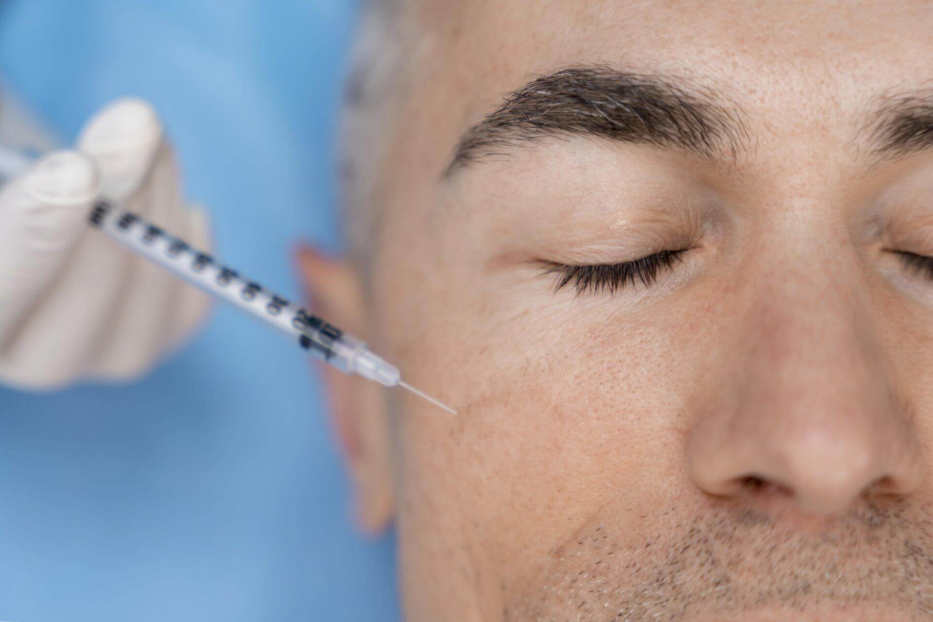 using dermal fillers for scar appearance