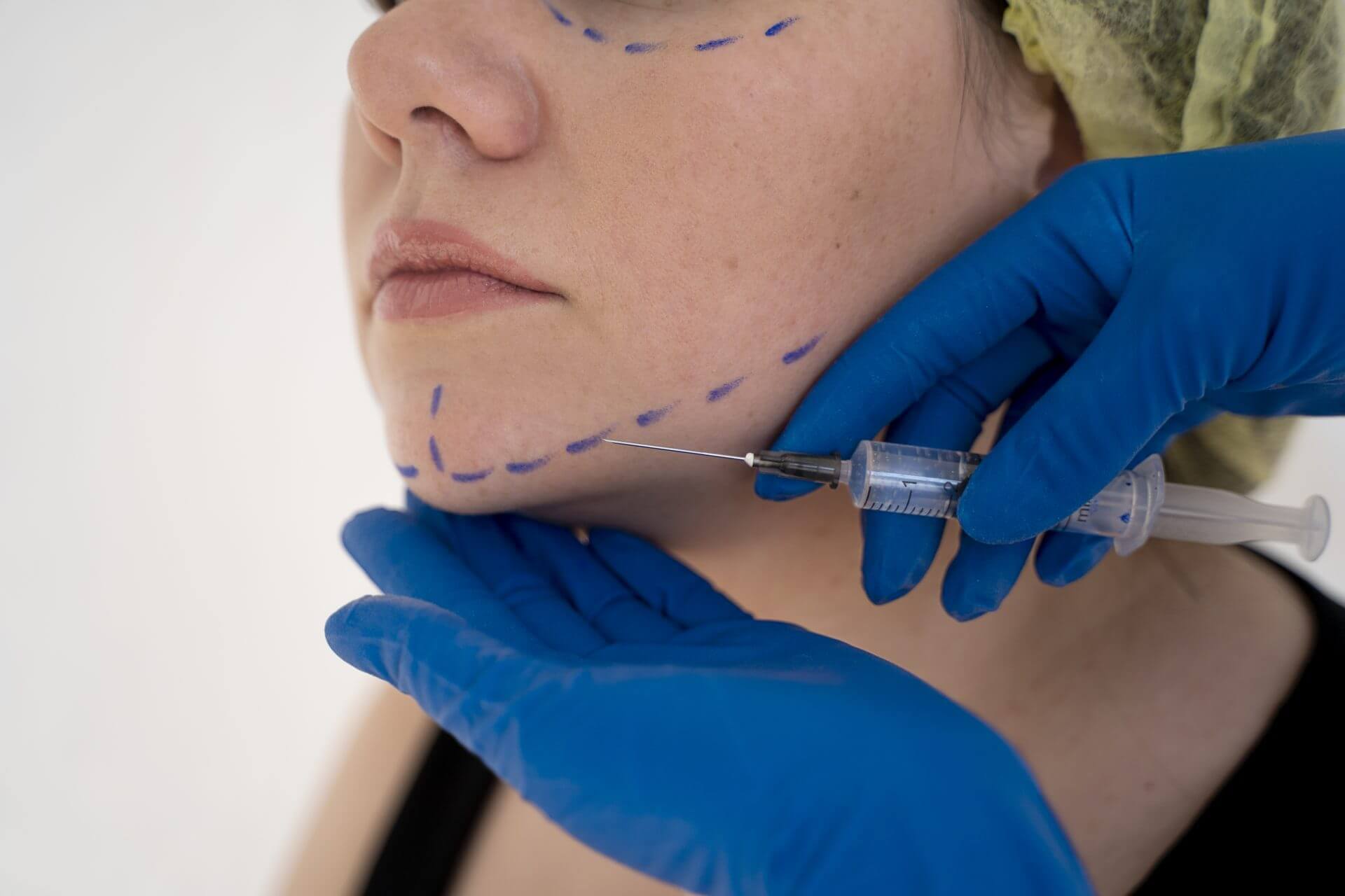 woman ready for fat injection