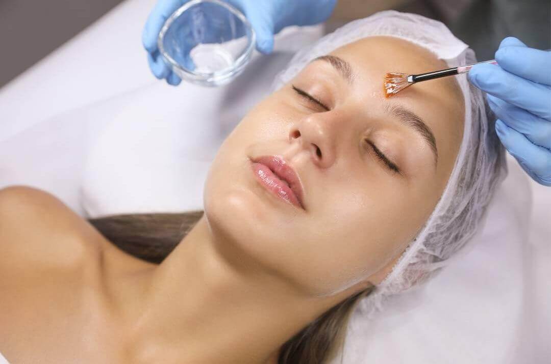 chemical peel in summer