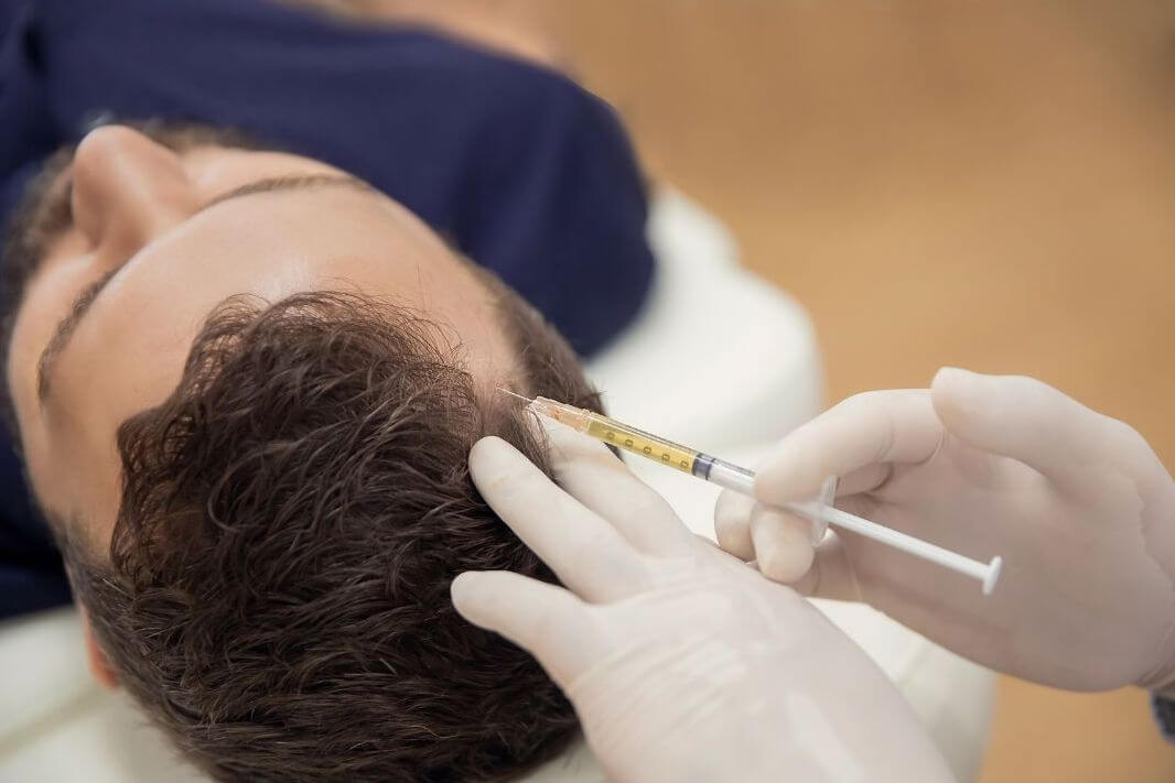botox injection into head for migraines