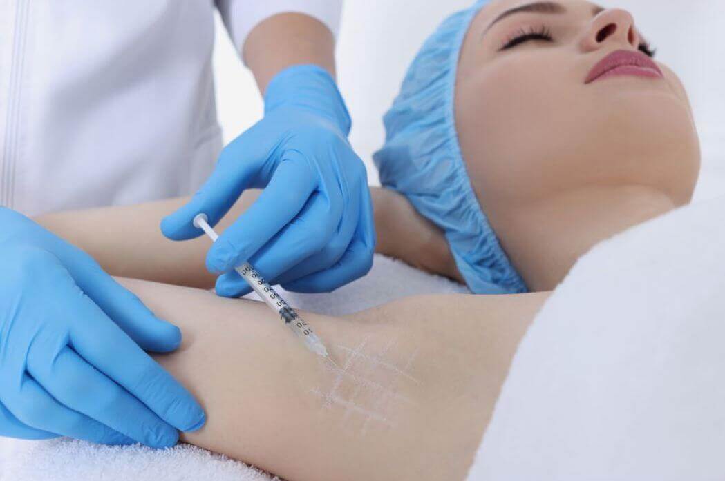 botox injections in armpit for hyperhidrosis