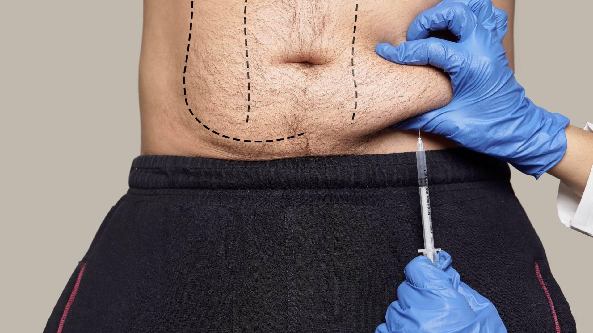 Fat Dissolving Injections