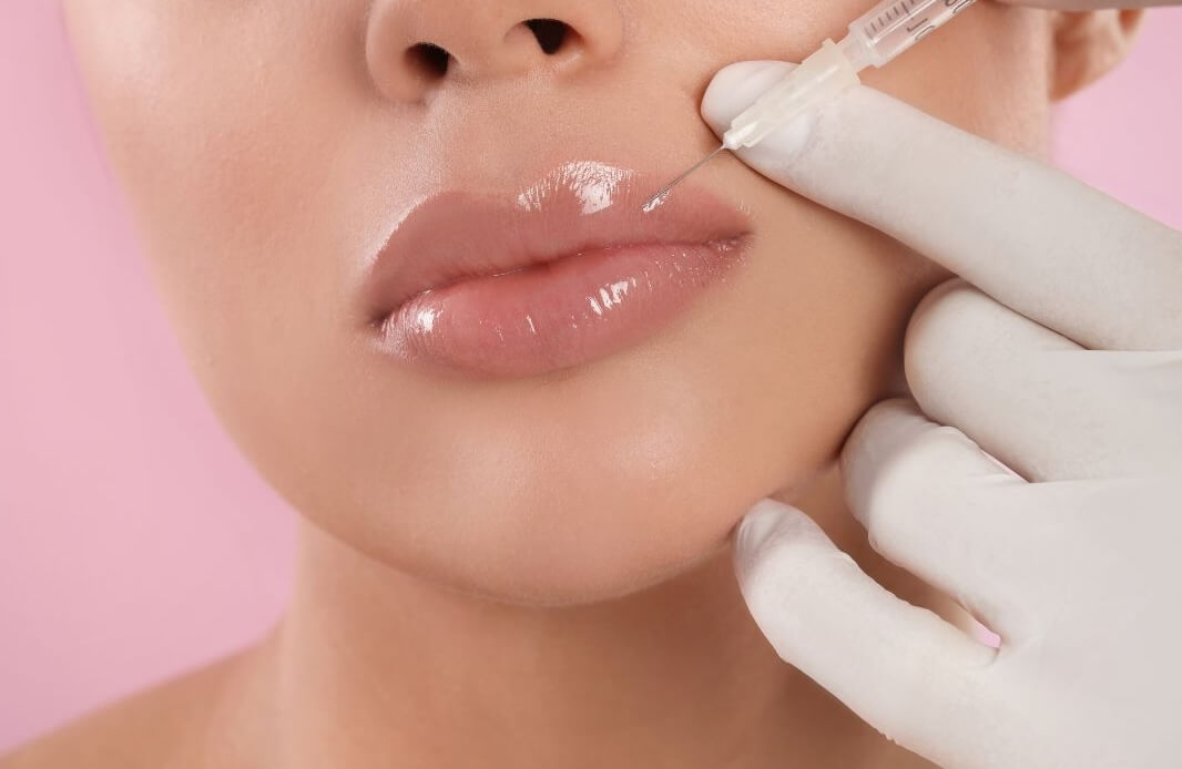 lip filler issues