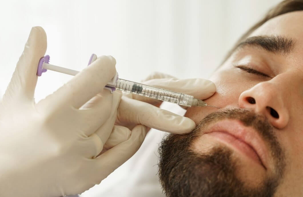 male dermal fillers