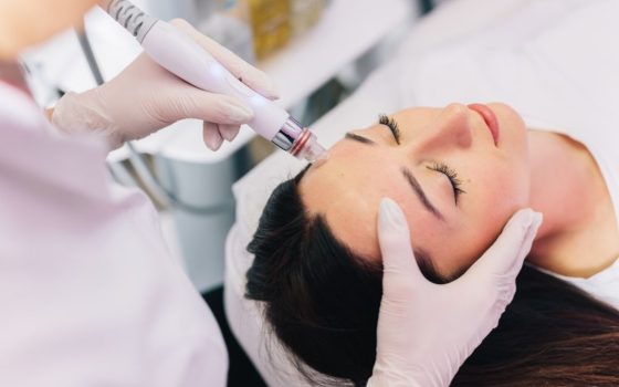 woman having microneedling