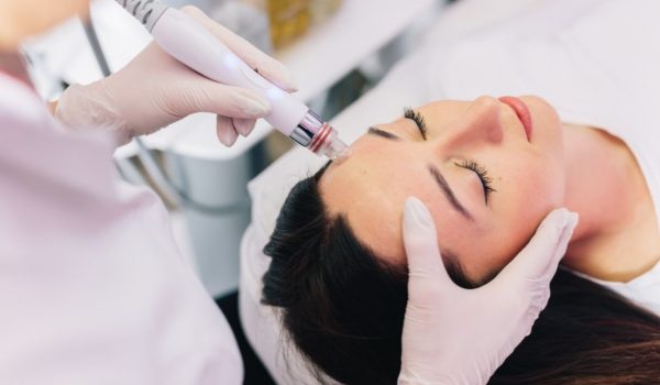 woman having microneedling