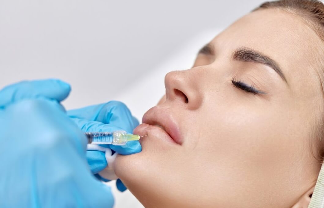 overfilled lip filler