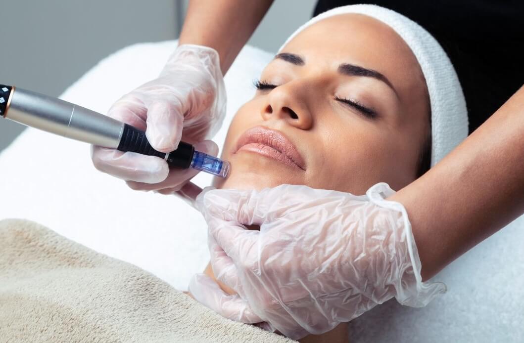 what is microneedling
